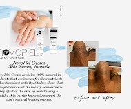 Before-and-after comparison showcasing the effects of JingoTel Cream on skin. Highlights smoother texture and enhanced skin health.