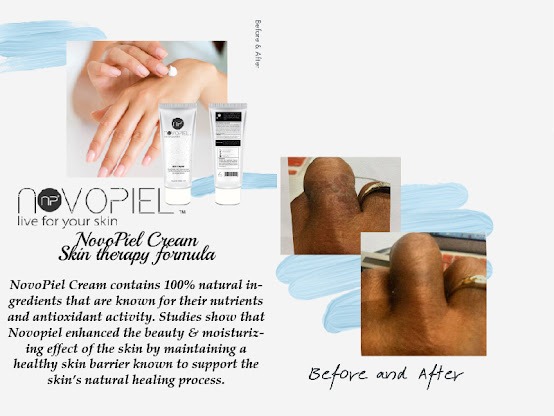 Novopiel with before and after